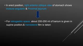 • In erect position, right anterior oblique view of stomach shows
incisura angularis & Proximal jejunum
• For retrogastric space, about 200-250 ml of barium is given in
supine position,& translateral film is taken
 