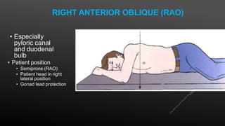 RIGHT ANTERIOR OBLIQUE (RAO)
• Especially
pyloric canal
and duodenal
bulb
• Patient position
• Semiprone (RAO)
• Patient head in right
lateral position
• Gonad lead protection
This is a right anterior oblique (RAO) position because the right side of the
anterior body surface is closest to the IMAGE RECEPTOR
 
