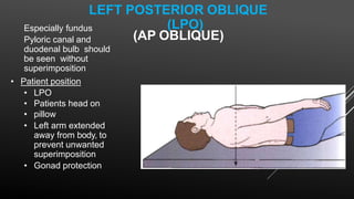 LEFT POSTERIOR OBLIQUE
(LPO)
(AP OBLIQUE)
Especially fundus
Pyloric canal and
duodenal bulb should
be seen without
superimposition
• Patient position
• LPO
• Patients head on
• pillow
• Left arm extended
away from body, to
prevent unwanted
superimposition
• Gonad protection
 