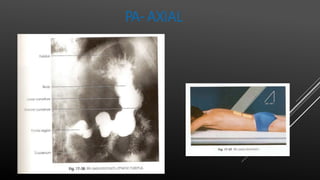 PA-AXIAL
 