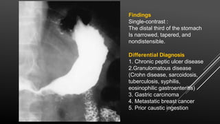 Findings
Single-contrast :
The distal third of the stomach
Is narrowed, tapered, and
nondistensible.
Differential Diagnosis
1. Chronic peptic ulcer disease
2.Granulomatous disease
(Crohn disease, sarcoidosis,
tuberculosis, syphilis,
eosinophilic gastroenteritis)
3. Gastric carcinoma
4. Metastatic breast cancer
5. Prior caustic ingestion
 