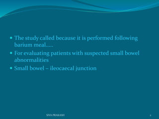  The study called because it is performed following
barium meal.....
 For evaluating patients with suspected small bowel
abnormalities
 Small bowel – ileocaecal junction
2SIVA PRAKASH
 