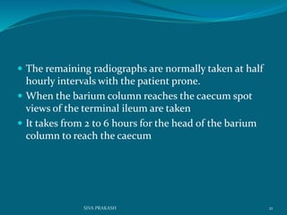  The remaining radiographs are normally taken at half
hourly intervals with the patient prone.
 When the barium column reaches the caecum spot
views of the terminal ileum are taken
 It takes from 2 to 6 hours for the head of the barium
column to reach the caecum
21SIVA PRAKASH
 