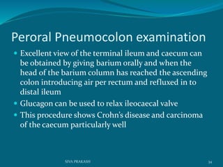 Peroral Pneumocolon examination
 Excellent view of the terminal ileum and caecum can
be obtained by giving barium orally and when the
head of the barium column has reached the ascending
colon introducing air per rectum and refluxed in to
distal ileum
 Glucagon can be used to relax ileocaecal valve
 This procedure shows Crohn’s disease and carcinoma
of the caecum particularly well
34SIVA PRAKASH
 