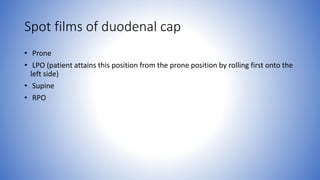 Spot films of duodenal cap
• Prone
• LPO (patient attains this position from the prone position by rolling first onto the
left side)
• Supine
• RPO
 