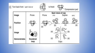 right lateral
LPO RPO
 