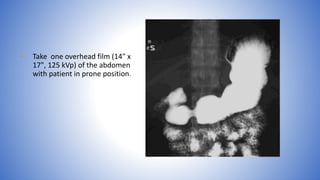 • Take one overhead film (14" x
17", 125 kVp) of the abdomen
with patient in prone position.
 