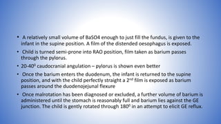 • A relatively small volume of BaSO4 enough to just fill the fundus, is given to the
infant in the supine position. A film of the distended oesophagus is exposed.
• Child is turned semi-prone into RAO position, film taken as barium passes
through the pylorus.
• 20-400 caudocranial angulation – pylorus is shown even better
• Once the barium enters the duodenum, the infant is returned to the supine
position, and with the child perfectly straight a 2nd film is exposed as barium
passes around the duodenojejunal flexure
• Once malrotation has been diagnosed or excluded, a further volume of barium is
administered until the stomach is reasonably full and barium lies against the GE
junction. The child is gently rotated through 1800 in an attempt to elicit GE reflux.
 
