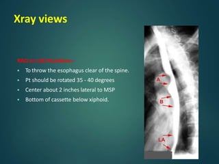 bariumprocedures-180530182835.pptx