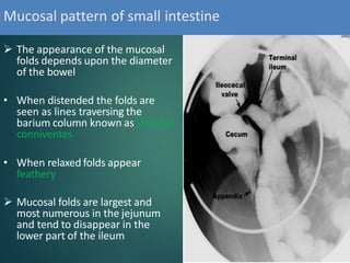 Valvulae bariumprocedures-180530182835.pptx