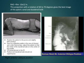 Barium procedures | PPTX