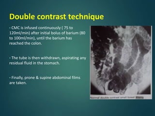 Bari Injection Barium procedures | PPTX