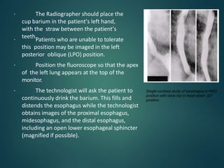 Lpo Radiography BARIUM PROCEEDURES 1.pptx