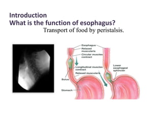 Introduction
What is the function of esophagus?
Transport of food by peristalsis.
 