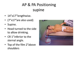 AP & PA Positioning
supine
• 14”x17”lengthwise.
• (7”x17”are also used)
• Supine.
• Head turned to the side
to allow drinking.
• CR 1”inferior to the
sternal angle.
• Top of the film 2”above
shoulders
 