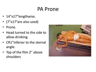 PA Prone
• 14”x17”lengthwise.
• (7”x17”are also used)
• Prone.
• Head turned to the side to
allow drinking.
• CR1”inferior to the sternal
angle.
• Top of the film 2” above
shoulders
 