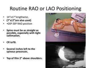 Routine RAO or LAO Positioning
• 14”x17”lengthwise.
• (7”x17”are also used)
• •20º-30º RAO position
• Spine must be as straight as
possible, especially with tight
collimation.
• CR toT8.
• Several inches left to the
spinous processes.
• Top of film 2” above shoulders.
 