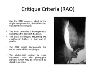 Critique Criteria (RAO)
• Like the RAO stomach, which is the
single best projection, the RAO is also
best for the esophagus.
• The heart provides a homogeneous
background to contrast it against.
• The distal esophagus, traversing the
esophageal hiatus, Is laid out in
profile.
• The RAO should demonstrate the
entire barium filled esophagus.
• The abdominal portion is more
important than the pharyngeal
portion, which may be evaluated by
direct inspection
 