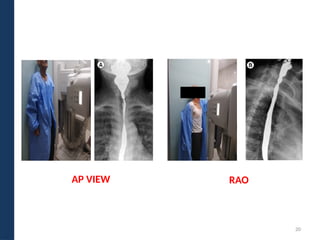 Barium Studies of upper GI Tract by joginder.pptx