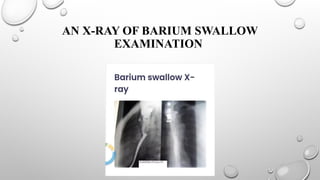 BARIUM STUDIES PRESENTATION RADIOGRAPHYpptx | PPTX