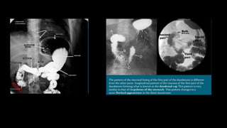 barium study1.docx