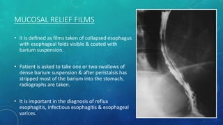 MUCOSAL RELIEF FILMS
• it is defined as films taken of collapsed esophagus
with esophageal folds visible & coated with
barium suspension.
• Patient is asked to take one or two swallows of
dense barium suspension & after peristalsis has
stripped most of the barium into the stomach,
radiographs are taken.
• It is important in the diagnosis of reflux
esophagitis, infectious esophagitis & esophageal
varices.
 