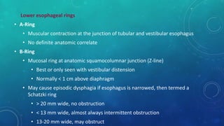 Lower esophageal rings
• A-Ring
• Muscular contraction at the junction of tubular and vestibular esophagus
• No definite anatomic correlate
• B-Ring
• Mucosal ring at anatomic squamocolumnar junction (Z-line)
• Best or only seen with vestibular distension
• Normally < 1 cm above diaphragm
• May cause episodic dysphagia if esophagus is narrowed, then termed a
Schatzki ring
• > 20 mm wide, no obstruction
• < 13 mm wide, almost always intermittent obstruction
• 13-20 mm wide, may obstruct
 