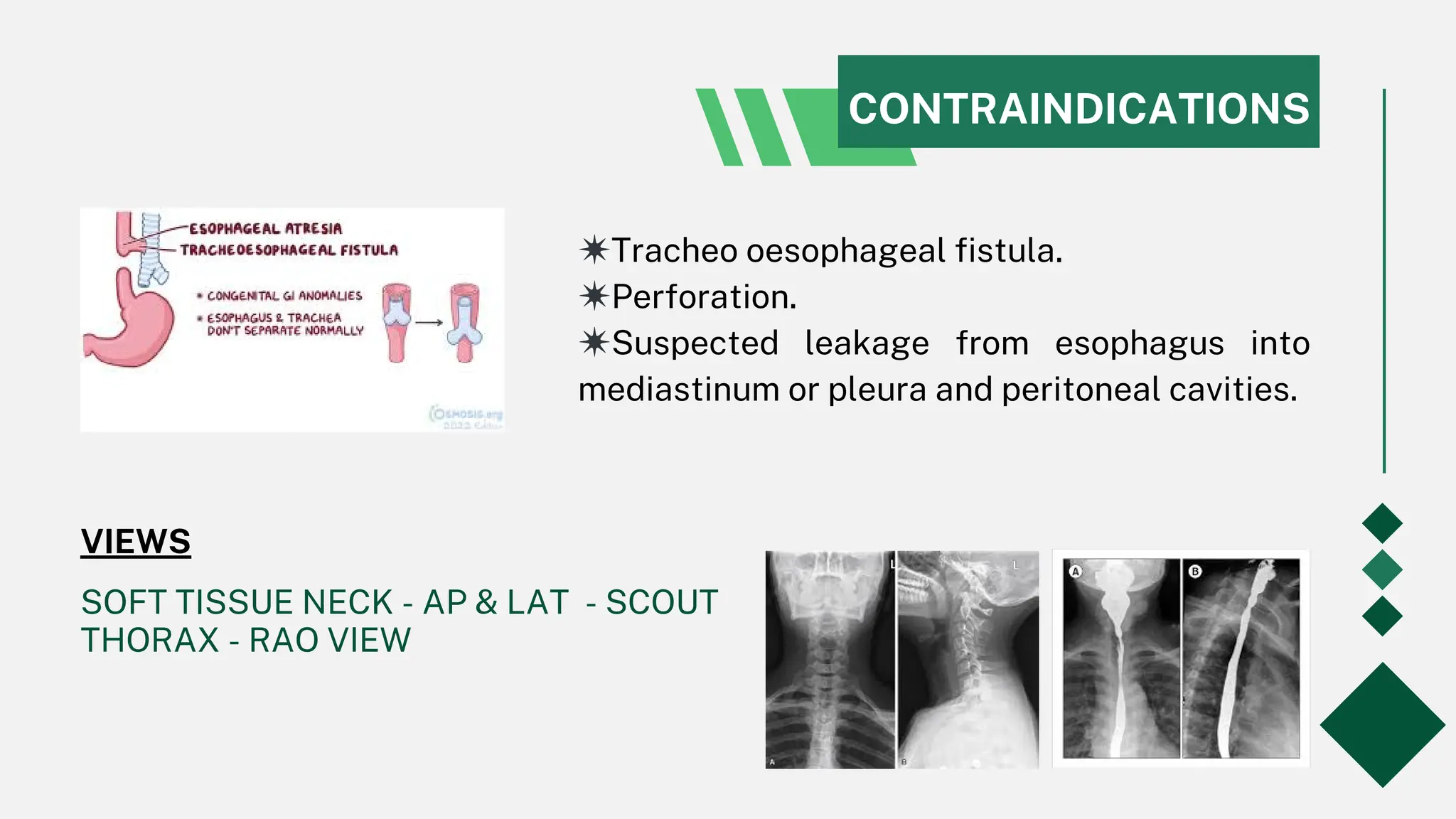 Barium Swallow procedure in radiology department | PPT