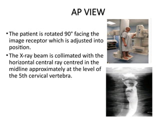 Comprehensive Overview of Barium Swallow Procedure in Radiodiagnosis | PPTX