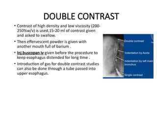 Comprehensive Overview of Barium Swallow Procedure in Radiodiagnosis | PPTX