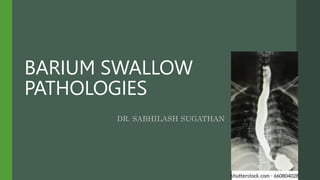BARIUM SWALLOW
PATHOLOGIES
DR. SABHILASH SUGATHAN
 