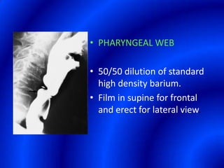 PHARYNGEAL WEB50/50 dilution of standard high density barium.Film in supine for frontal and erect for lateral view.P