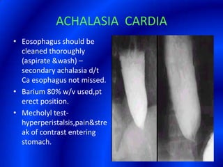 ACHALASIA  CARDIAEosophagus should be cleaned thoroughly (aspirate &wash) –secondary achalasia d/t Ca esophagus not missed.Barium 80% w/v used,pt erect position.Mecholyl test-hyperperistalsis,pain&streak of contrast entering stomach.