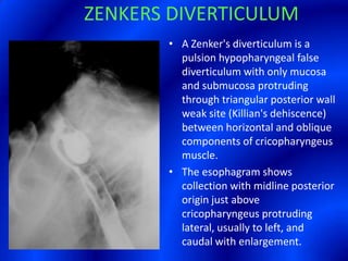 	ZENKERS DIVERTICULUMZENKER’S DIVERTICULUMA Zenker's diverticulum is a pulsionhypopharyngeal false diverticulum with only mucosa and submucosa protruding through triangular posterior wall weak site (Killian's dehiscence) between horizontal and oblique components of cricopharyngeus muscle. The esophagram shows collection with midline posterior origin just above cricopharyngeus protruding lateral, usually to left, and caudal with enlargement.