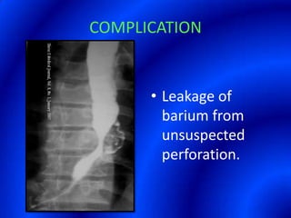 COMPLICATIONLeakage of barium from unsuspected perforation.