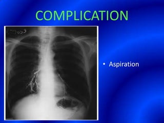 COMPLICATIONAspiration