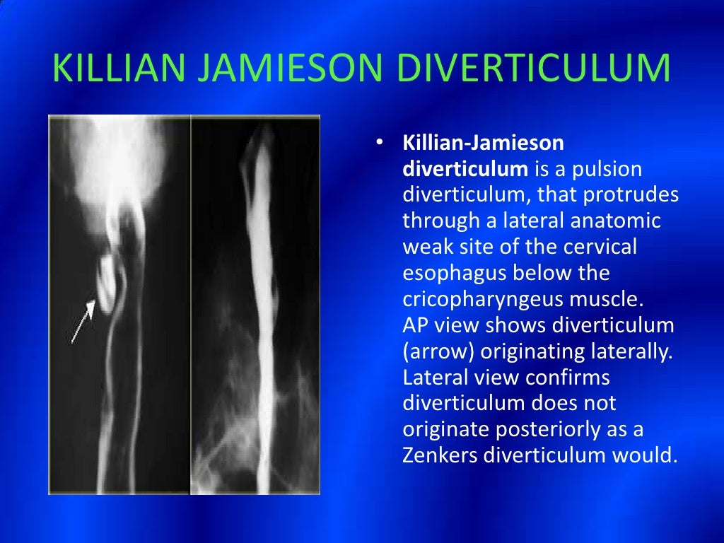 Barium Swallow Presentation