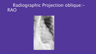 Barium swallow. Srinivas Rao Khorfakkhan hospital | PPTX