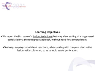 Learning Objectives
•We report the first case of a bailout technique that may allow sealing of a large vessel
perforation via the retrograde approach, without need for a covered stent.
•To always employ contralateral injections, when dealing with complex, obstructive
lesions with collaterals, so as to avoid vessel perforation.
 