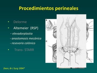 • Delorme
• Altemeier (RSP)
- elevadorplastia
- anastomosis mecánica
- resevorio colónico
• Trans- STARR
Procedimientos perineales
Deen, Br J Surg 1994*
 