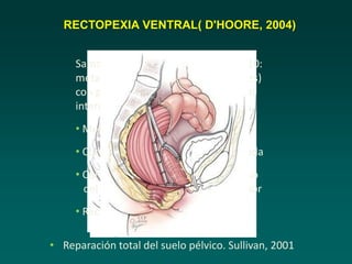 RECTOPEXIA VENTRAL( D'HOORE, 2004)
• Reparación total del suelo pélvico. Sullivan, 2001
Samaranayake CB, Colorectal Dis, 2010:
meta-analisis (12 estudios de cohortes)
con prolapso completo e invaginación
interna:
• Mejora el estreñimiento obstructivo
• Corrige la incontinencia fecal asociada
• Corrige simultáneamente el prolapso
del compartimento medio y posterior
• Recurrencias anatómicas: <5%
 