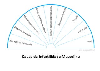 Causa da Infertilidade Masculina
 