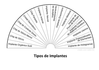 Tipos de Implantes
 
