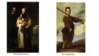 The bearded woman The clubfoot boy
 