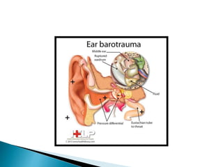 Barotrauma Telinga Tengah | PPT