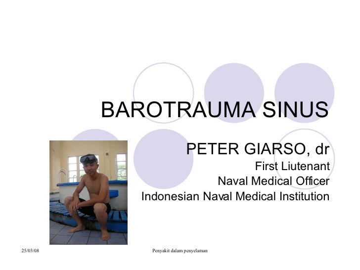 Barotrauma sinus