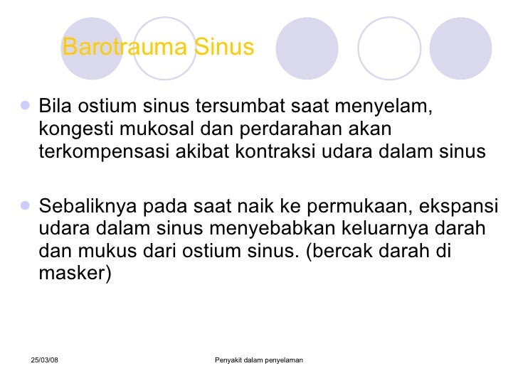 Barotrauma sinus