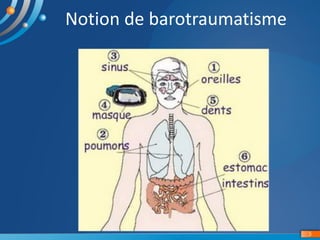 Barotraumatisme versus Accident de décompresion (ADD) Slide 5