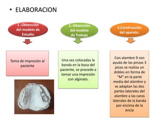 • ELABORACION
1.-Obtención
del modelo de
Estudio
2.-Obtención
del modelo
de Trabajo
3.Construcción
del aparato.
Toma de impresión al
paciente
Una vez colocadas la
banda en la boca del
paciente, se procede a
tomar una impresión
con alginato.
Con alambre 9 con
ayuda de las pinzas 3
picos se realiza un
dobles en forma de
“M” en la parte
media del alambre y
se adaptan las dos
partes laterales del
alambre a las caras
laterales de la banda
por encima de la
encía
 