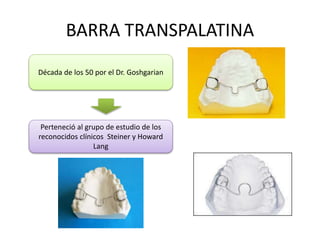 BARRA TRANSPALATINA
Década de los 50 por el Dr. Goshgarian
Perteneció al grupo de estudio de los
reconocidos clínicos Steiner y Howard
Lang
 